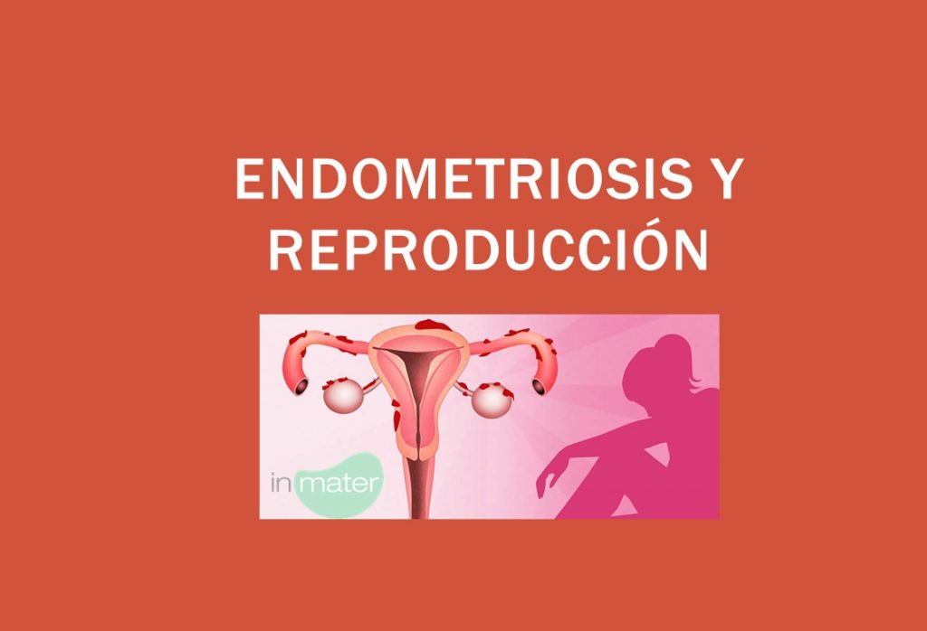 Endometriosis Noticias Inmater 0893